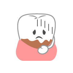 歯垢に困る歯