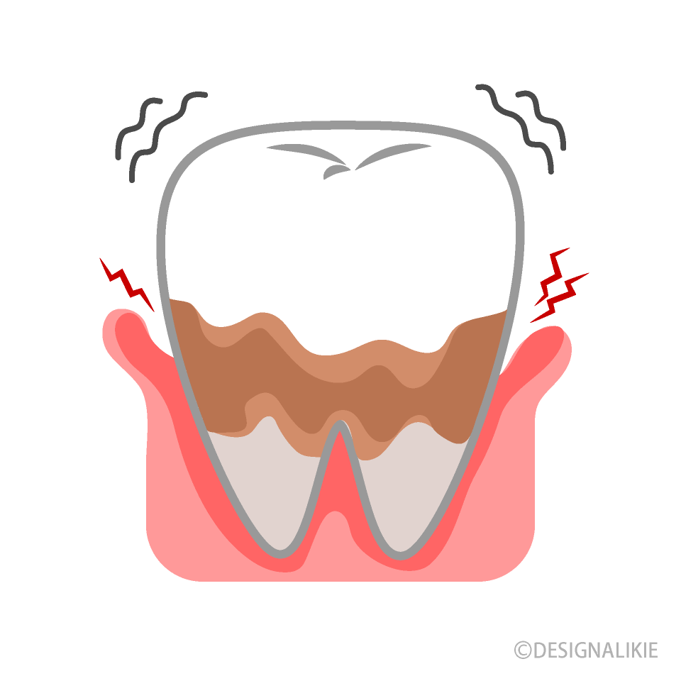 美しい花の画像 ベスト50 かわいい 歯 周 病 イラスト