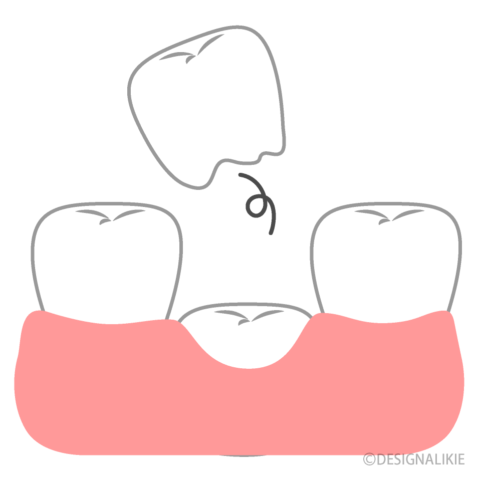 乳歯の生え変わりの無料イラスト素材 イラストイメージ