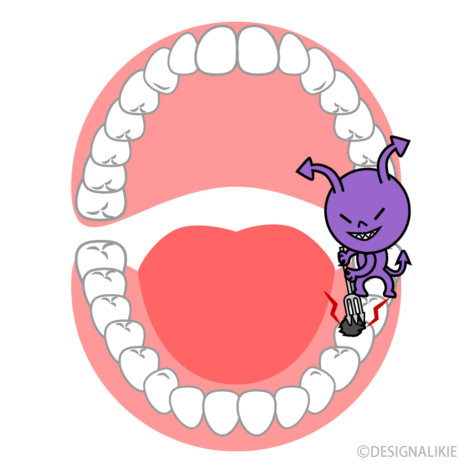 口の中の虫歯のばい菌の無料イラスト素材 イラストイメージ